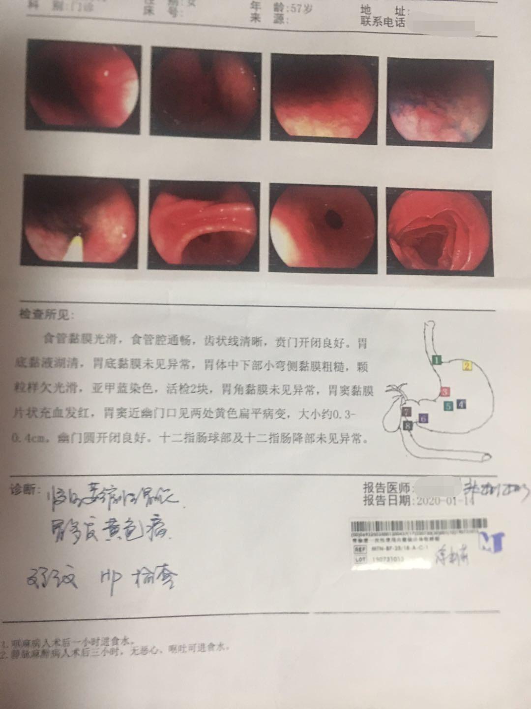 胃炎治疗之路，吃麦滋林三个月的体验与反思