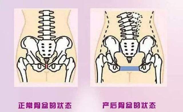 孕7个月耻骨疼，原因、缓解与注意事项