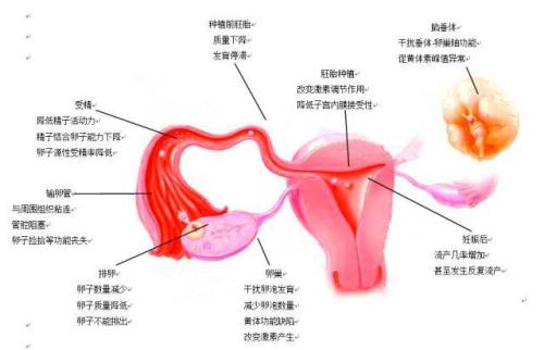 孕五个月白带多是否正常，深度解析与关注